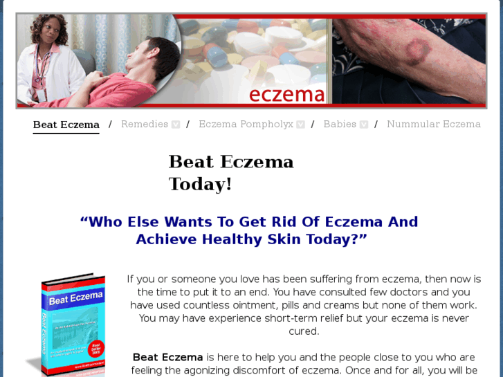 www.infoeczemaremedies.com