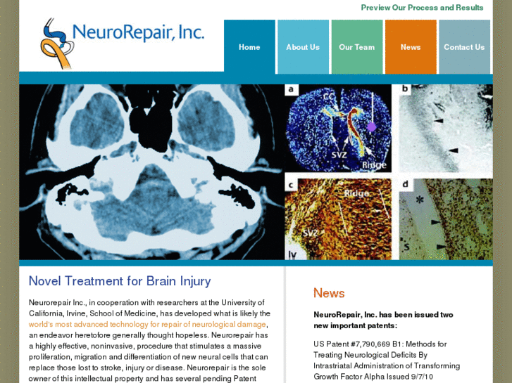 www.neurorepair.com