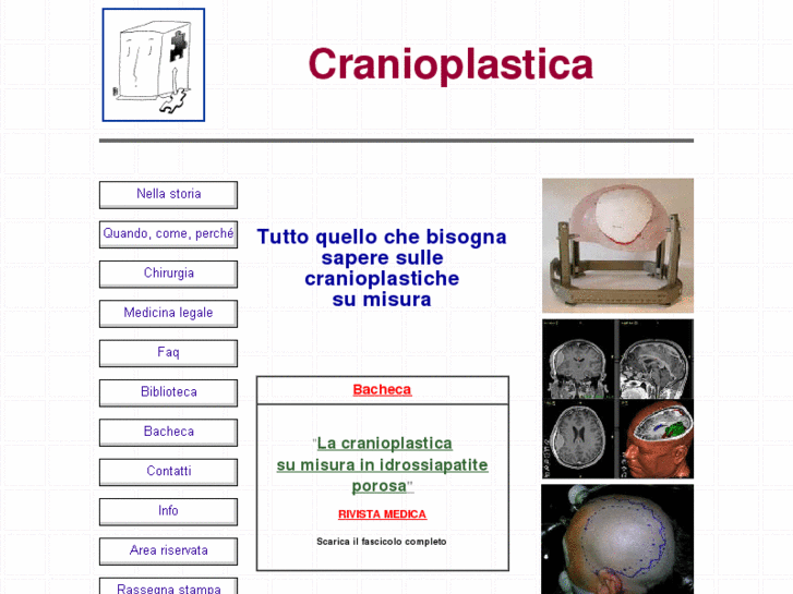 www.cranioplastica.it