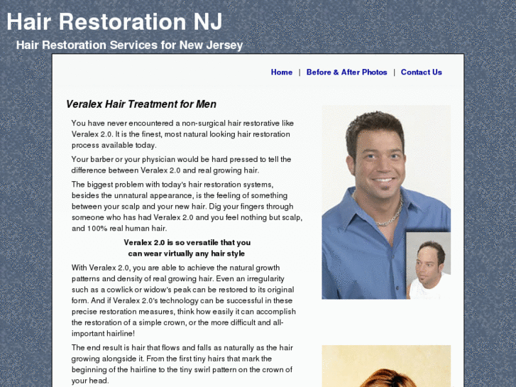 www.hair-restoration-nj.com