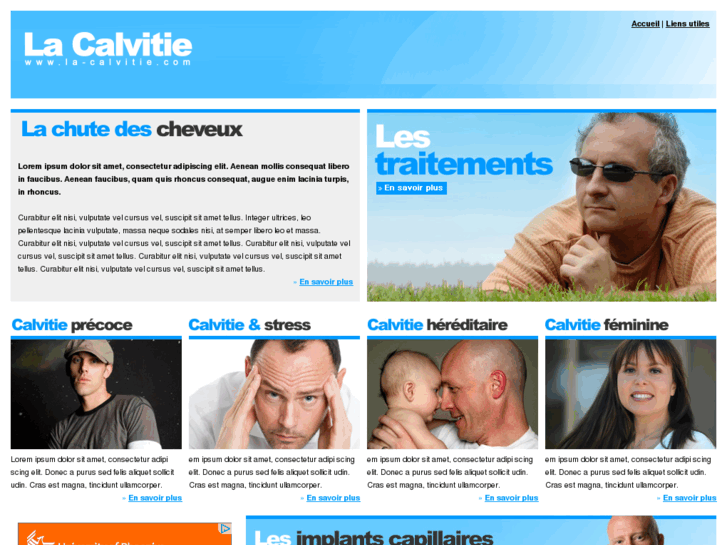 www.la-calvitie.com