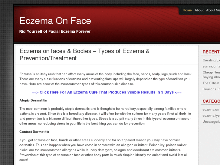 www.eczemaonface.org