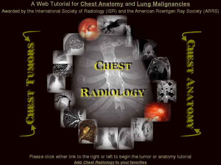 www.chestradiology.net