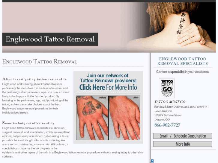 www.englewoodtattooremoval.com