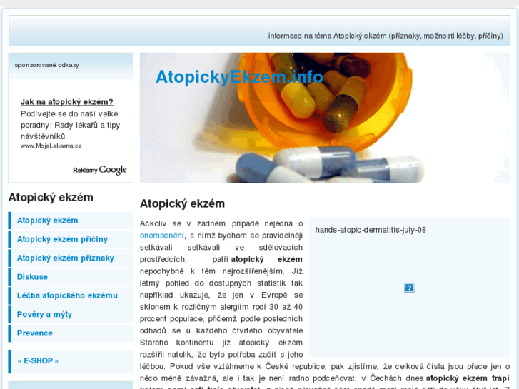 www.atopickyekzem.info