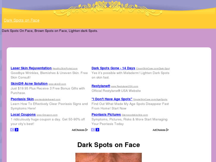 www.darkspotsonface.com