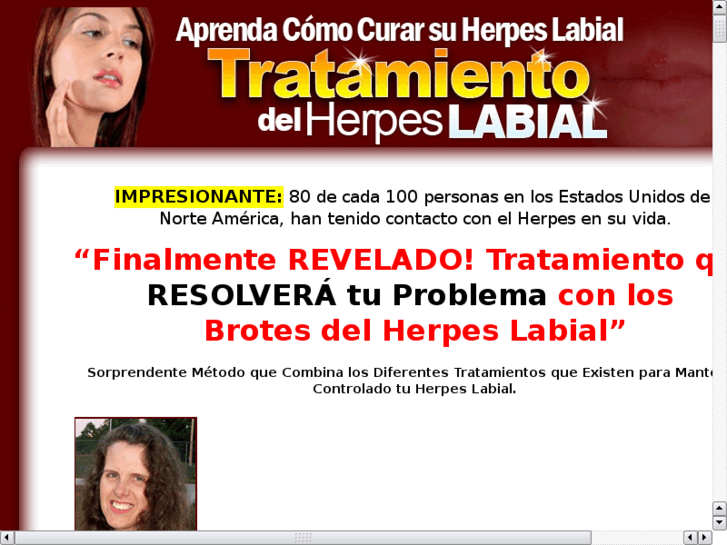 www.herpes-labial.info