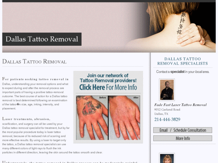 www.dallastattooremoval.com