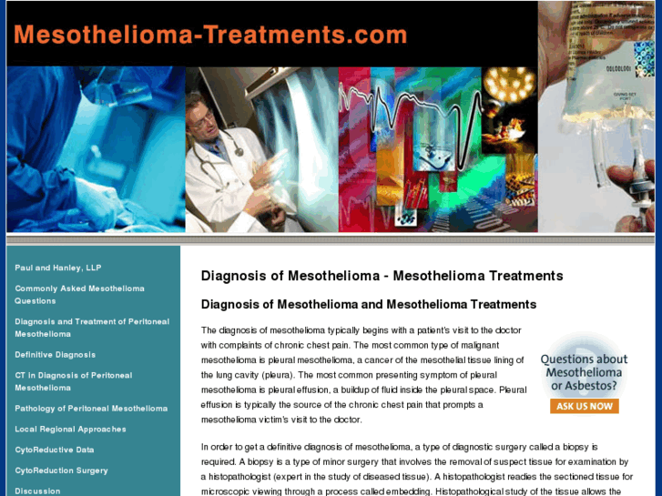 www.mesothelioma-treatments.com