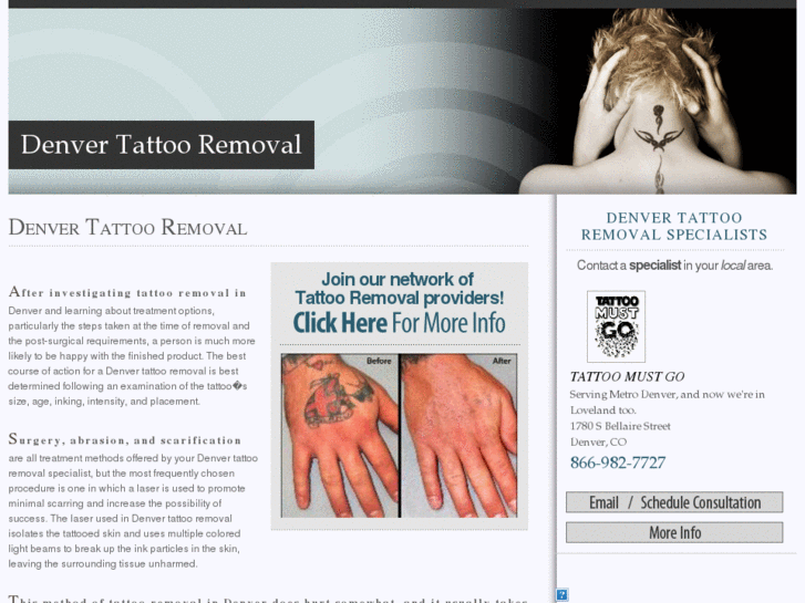 www.denvertattooremoval.net