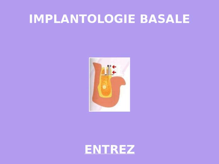 www.implantologiebasale.com