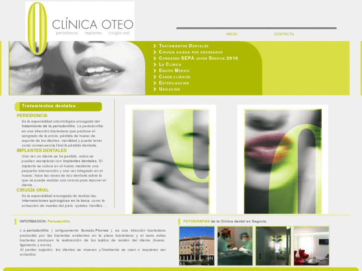 www.clinicaoteo.com