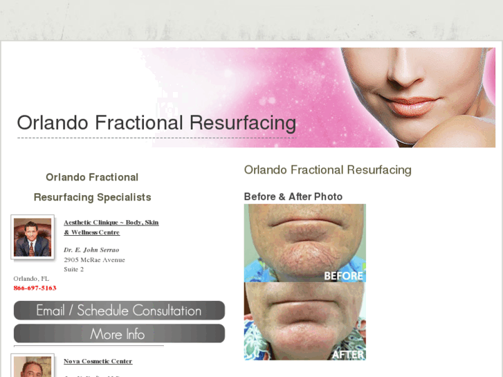 www.orlandofractionalresurfacing.com