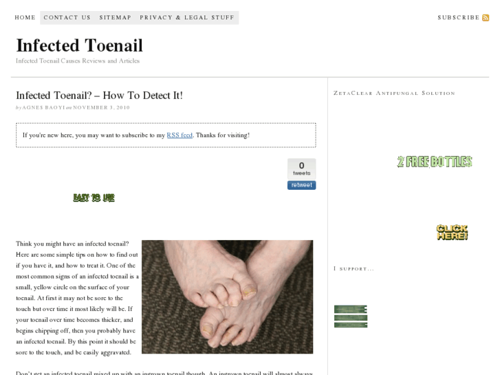 www.infectedtoenail911.org