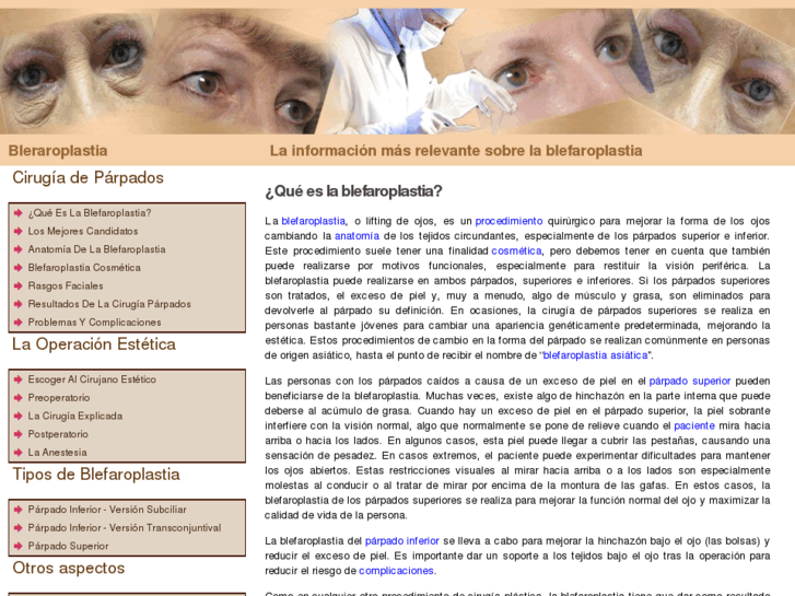 www.blefaroplastia.org.es