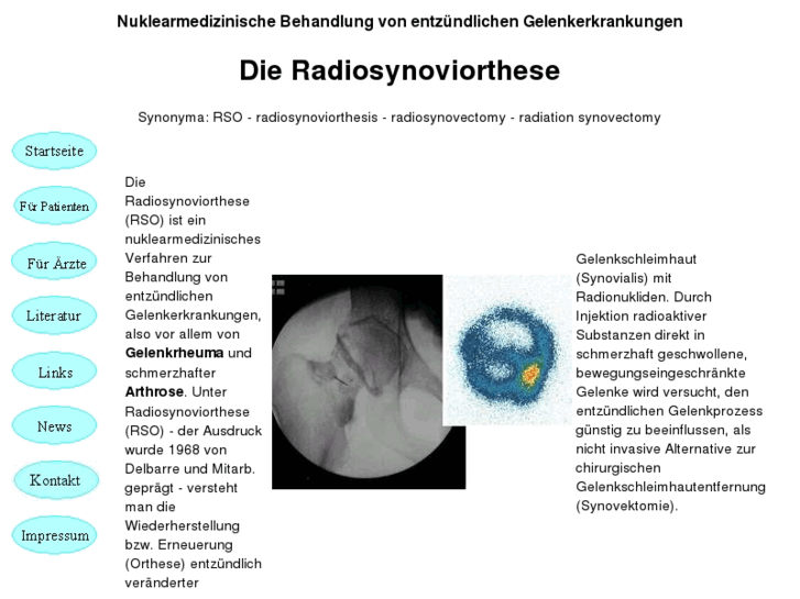 www.radiosynoviorthesis.com