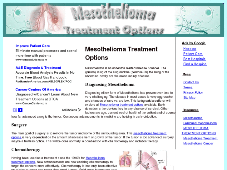 www.mesotheliomatreatment-options.net