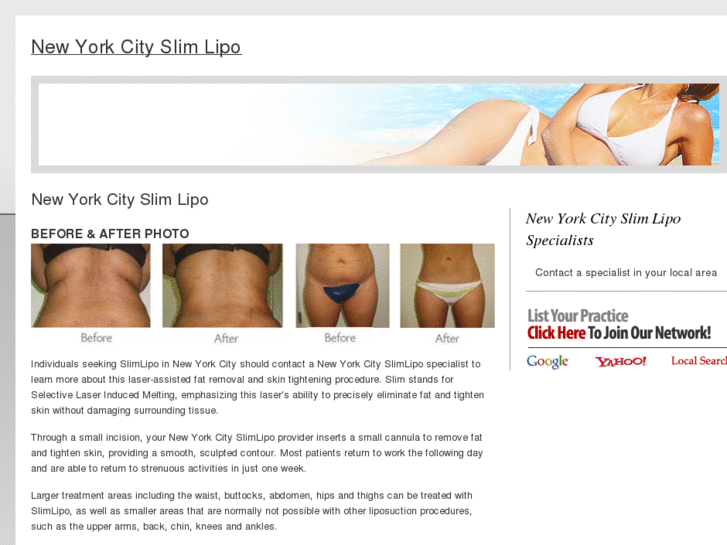 www.newyorkcityslimlipo.com