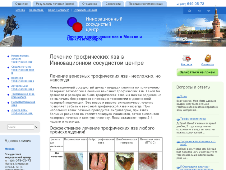 www.ulcus.ru