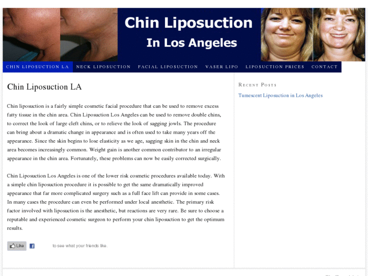 www.chinliposuctionlosangeles.com