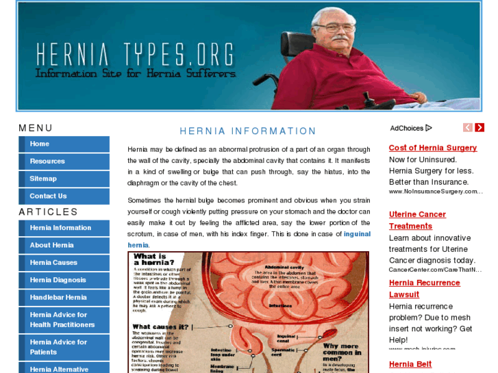 www.herniatypes.org