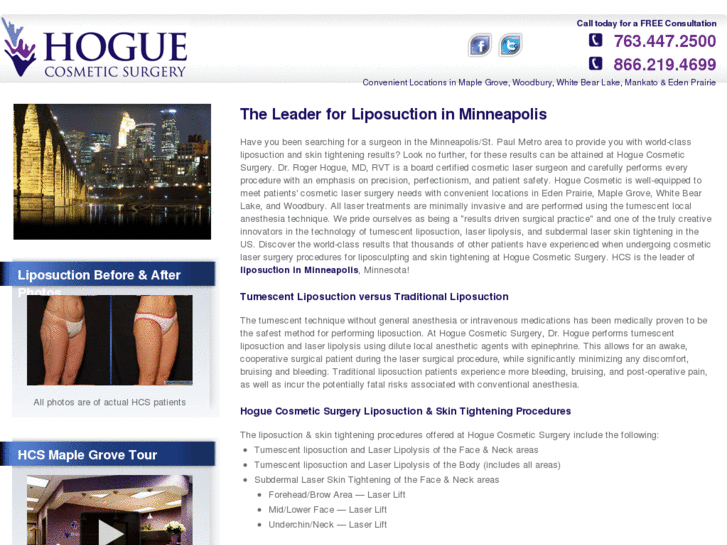 www.liposuctioninminneapolis.com