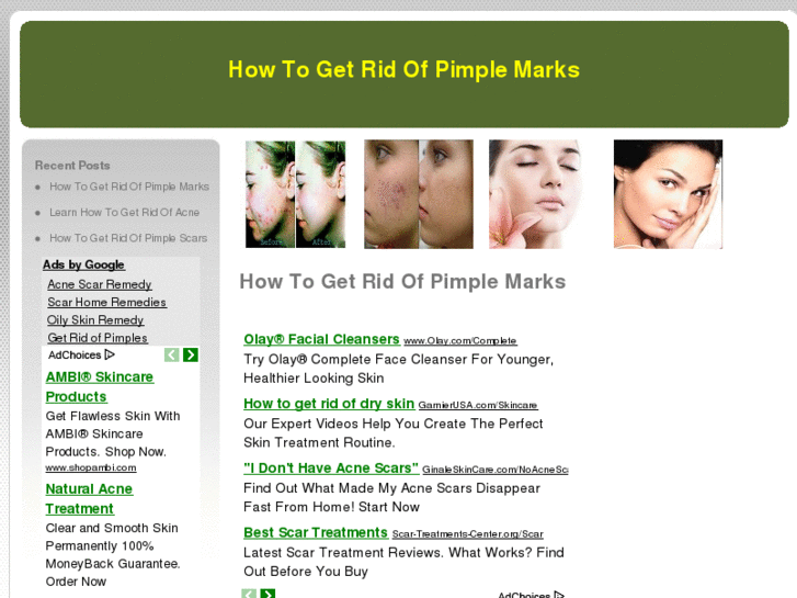 www.howtogetridofpimplemarks.net