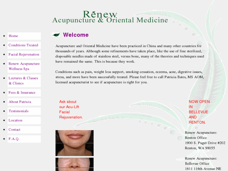 www.renewacupuncture.org