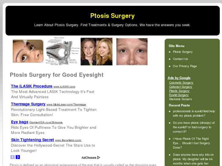 www.ptosissurgery.net