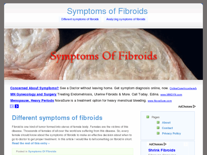 www.symptomsoffibroids.net