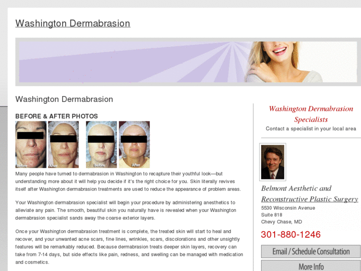 www.washingtondermabrasion.com