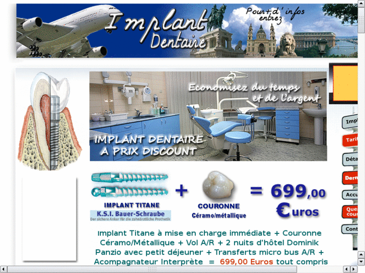 www.implantdentaire.biz