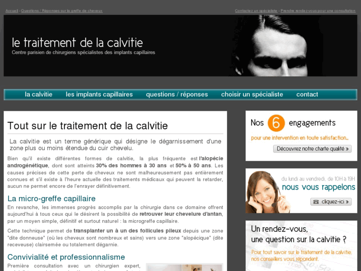 www.calvitie-madeleine.com