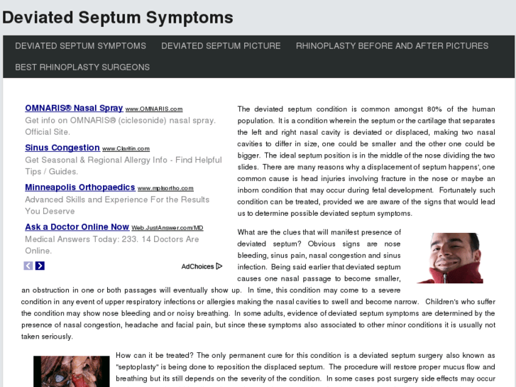 www.deviatedseptumsymptoms.net