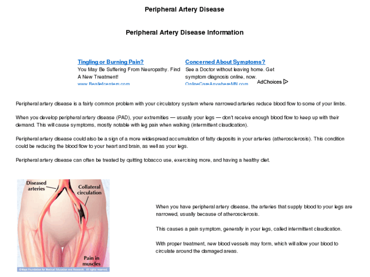 www.peripheral-artery-disease.com