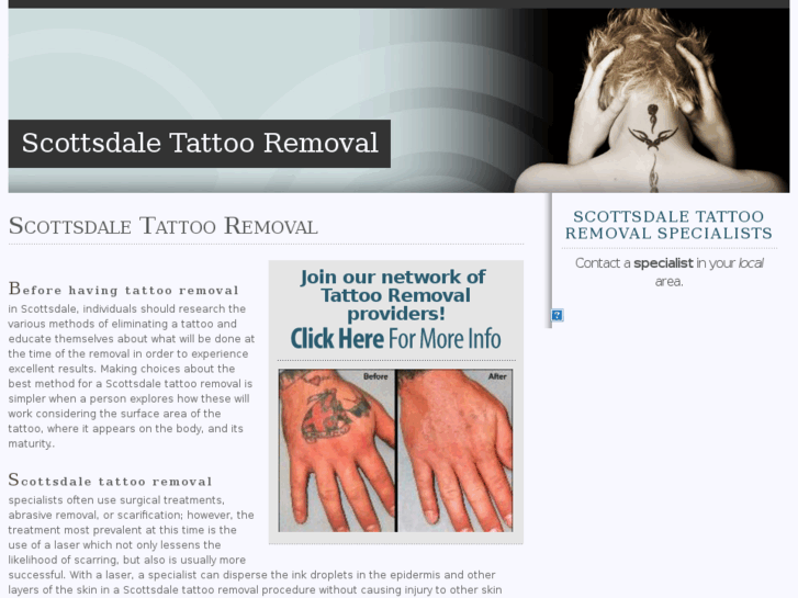 www.scottsdaletattooremoval.com