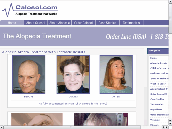 www.hairgrowth.com