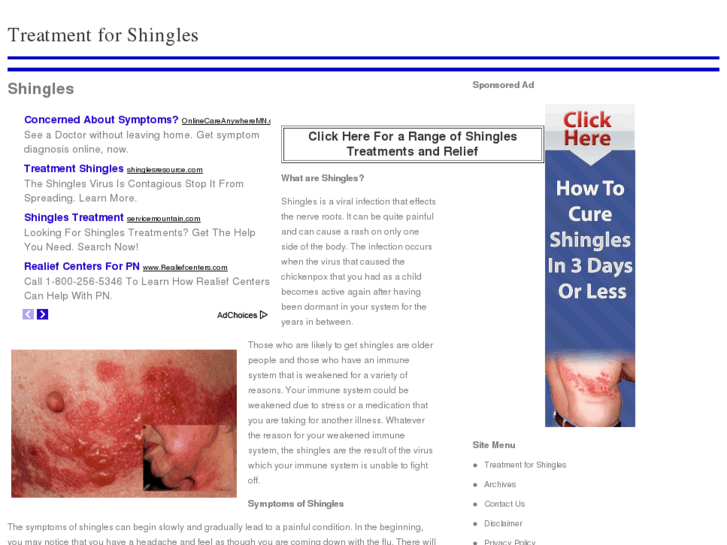 www.treatmentforshingles-info.com