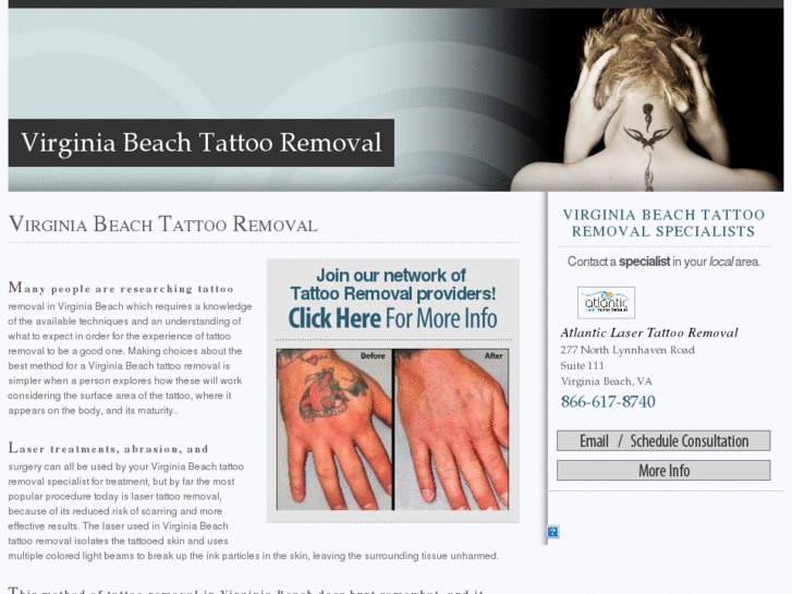 www.virginiabeachtattooremoval.com