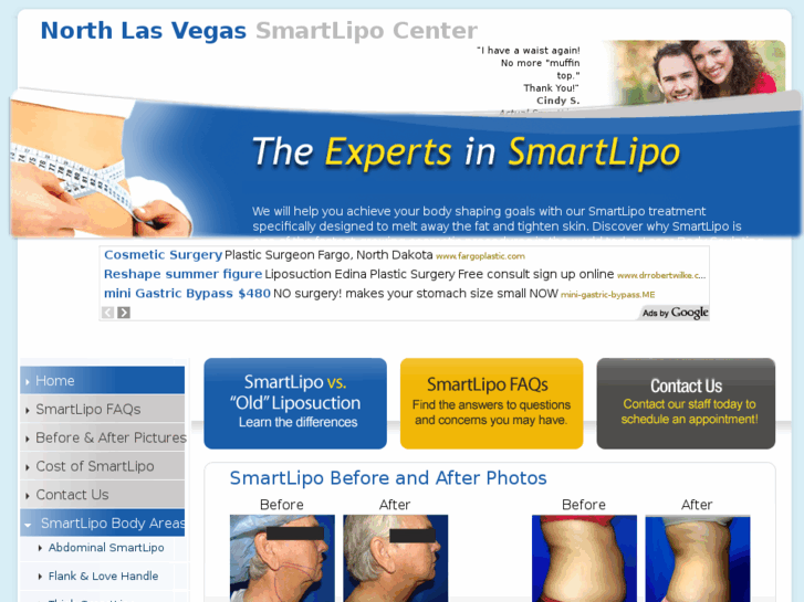 www.northlasvegassmartlipocenter.com