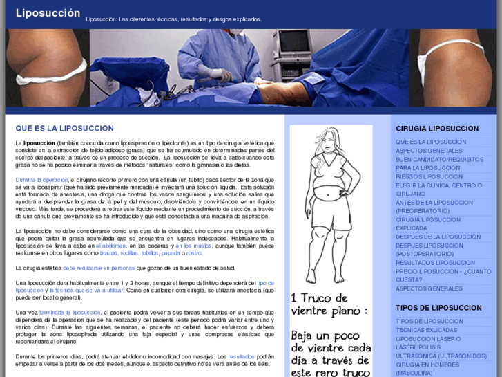 www.liposuccion.org.es