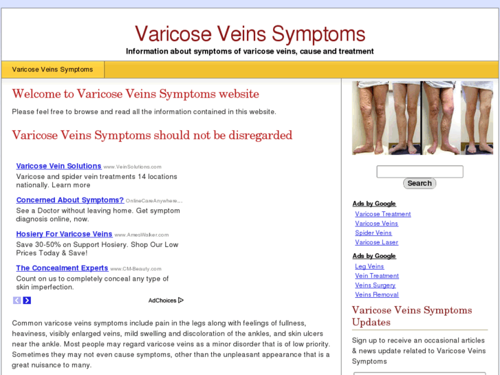 www.varicoseveinssymptoms.com