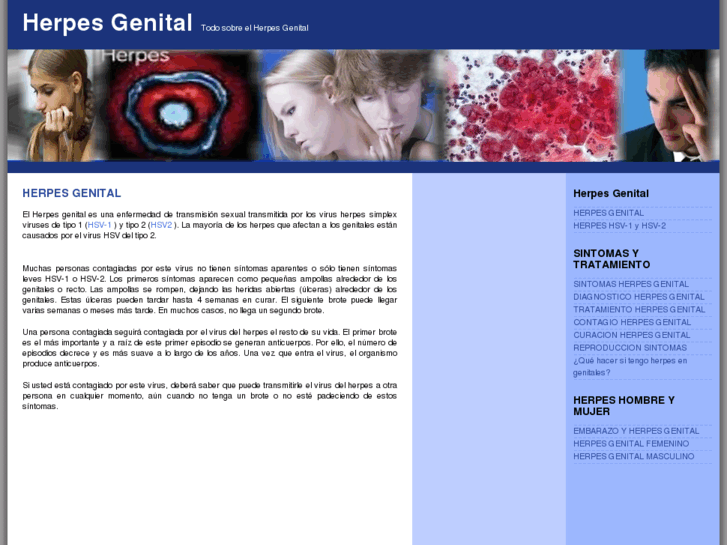 www.herpesgenital.com.es