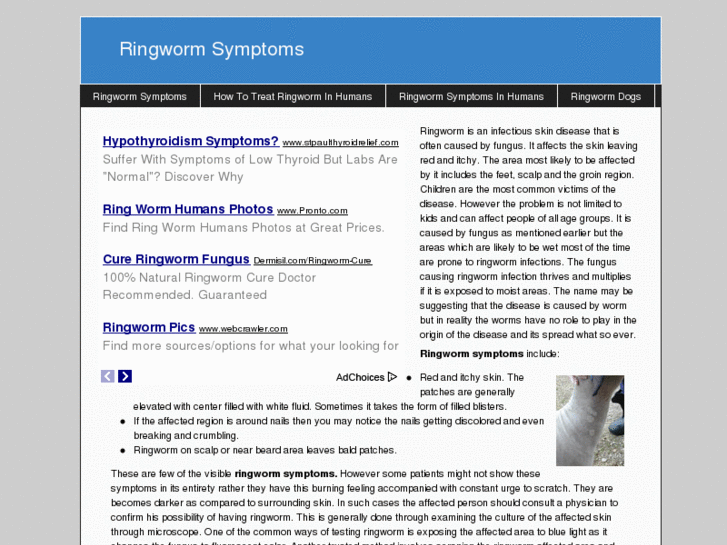 www.ringwormsymptoms.info