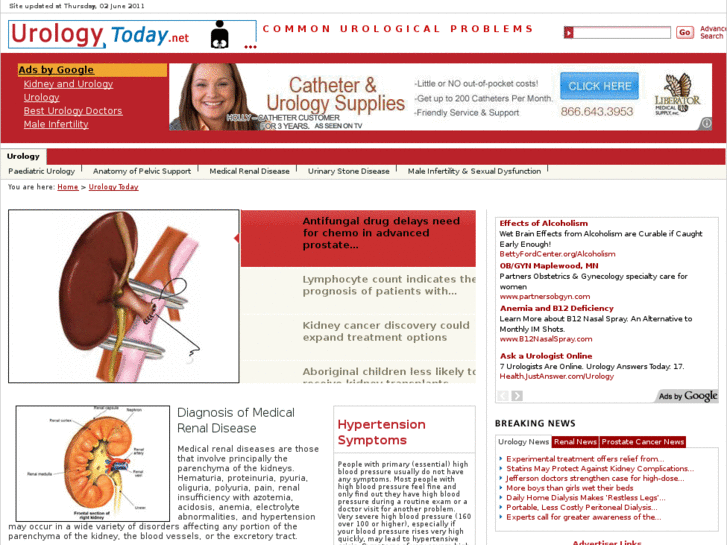 www.urologytoday.net