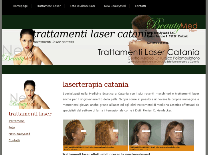 www.trattamenti-laser-catania.com