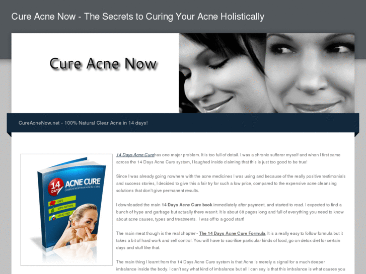 www.cureacnenow.net