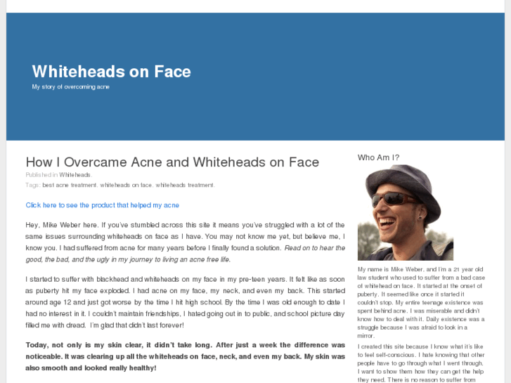 www.whiteheadsonface.com