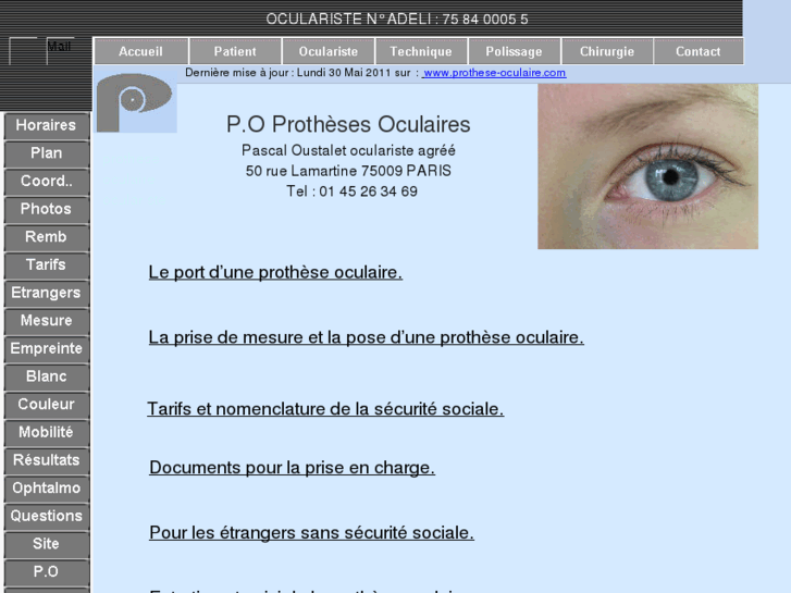 www.prothese-oculaire.com