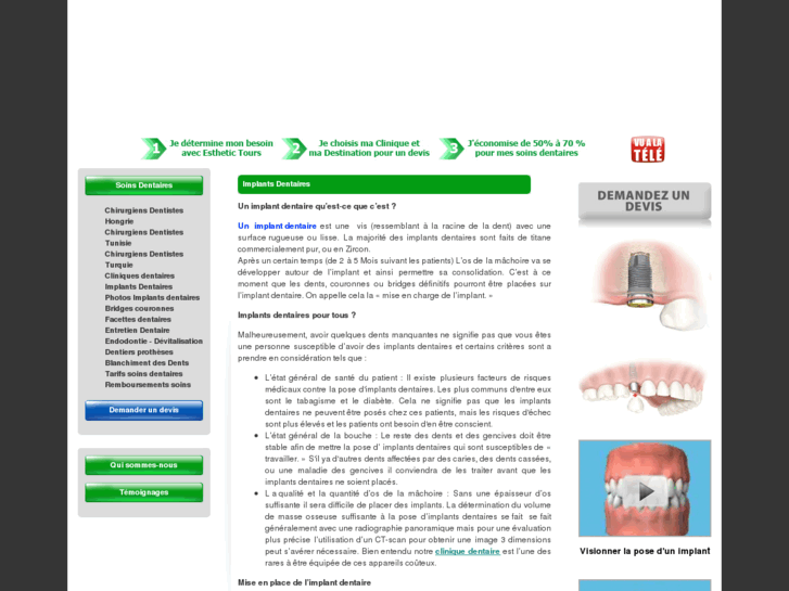 www.prix-implants-dentaires.com